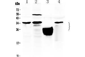 Western blot analysis of TFPI2 using anti- TFPI2 antibody . (TFPI2 antibody  (N-Term))