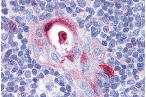 Immunohistochemistry (Formalin-fixed Paraffin-embedded Sections) (IHC (fp)) image for anti-Spleen Focus Forming Virus (SFFV) Proviral Integration Oncogene Spi1 (SPI1) (AA 1-122) antibody (ABIN574131)