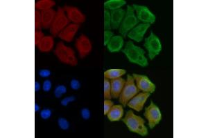 ABIN6257000 and ABIN6274216 staining Hela cells(45 min of heat-shock) by IF/ICC.