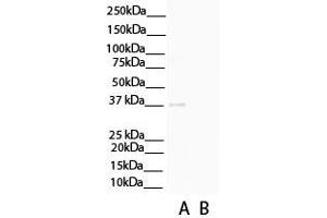 C1QTNF3 anticorps  (N-Term)