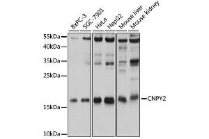 Western blot analysis of extracts of various cell lines, using CNPY2 antibody. (CNPY2/MSAP antibody  (AA 1-182))