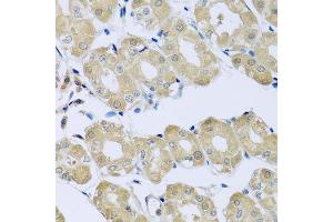 Immunohistochemistry of paraffin-embedded human stomach using SYT4 antibody at dilution of 1:100 (x40 lens).