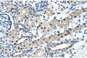Immunohistochemical staining (Formalin-fixed paraffin-embedded sections) of human kidney with IGSF1 polyclonal antibody  at 4-8 ug/mL working concentration.