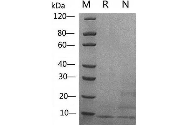IGF1 Protein (AA 49-118)