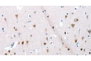 Immunohistochemistry of paraffin-embedded Human brain using POMC Polyclonal Antibody at dilution of 1:30 (POMC antibody)