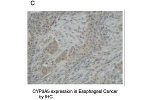C. (CYP3A5 antibody  (C-Term))