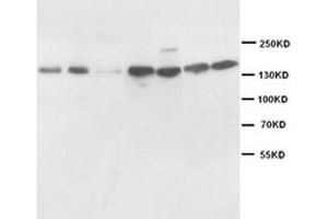 Western Blotting (WB) image for anti-Nitric Oxide Synthase 1, Neuronal (NOS1) (AA 1-181), (N-Term) antibody (ABIN1108474) (NOS1 antibody  (N-Term))