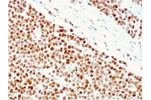 Formalin-fixed, paraffin-embedded human Small Intestine stained with MSH6 Mouse Monoclonal Antibody (MSH6/3086). (MSH6 antibody  (AA 374-540))