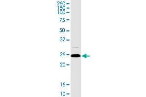 ARHGDIA MaxPab rabbit polyclonal antibody. (ARHGDIA antibody  (AA 1-204))