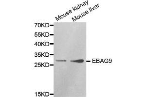 Western blot analysis of extracts of various cell lines, using EBAG9 antibody.