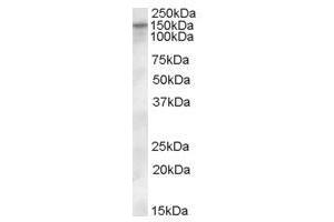 Image no. 1 for anti-Solute Carrier Family 12 (Potassium-Chloride Transporter) Member 4 (SLC12A4) (Internal Region) antibody (ABIN374882) (SLC12A4 antibody  (Internal Region))
