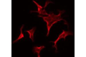 ABIN6267678 staining HepG2 by IF/ICC. (ESR2 antibody  (pSer105))