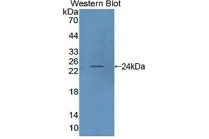 Western blot analysis of the recombinant protein. (PTPRN2 antibody  (AA 839-1015))
