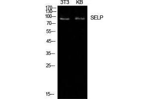 Western Blot (WB) analysis of NIH-3T3, KB cells using P-Selectin Polyclonal Antibody. (P-Selectin antibody  (Internal Region))
