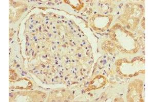 Immunohistochemistry of paraffin-embedded human kidney tissue using ABIN7166759 at dilution of 1:100 (FBXO11 antibody  (AA 181-453))