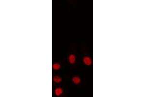ABIN6274239 staining HeLa cells by IF/ICC. (RORA antibody  (N-Term))