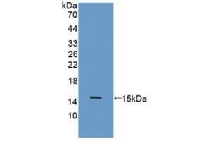 Procalcitonin antibody  (AA 26-130)