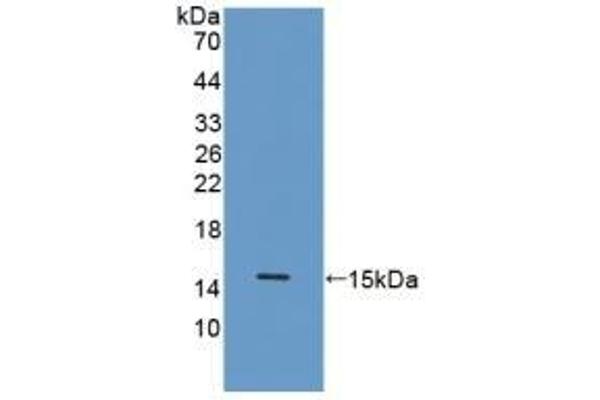 Procalcitonin antibody  (AA 26-130)