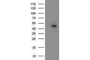 Western Blotting (WB) image for anti-Mitochondrial Methionyl-tRNA Formyltransferase (MTFMT) (AA 175-389) antibody (ABIN1491020)