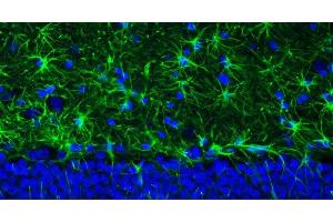 Representative section of formalin fixed, paraffin-embedded rat brain hippocampus region showing staining of GFAP. (GFAP antibody  (AA 411-422))