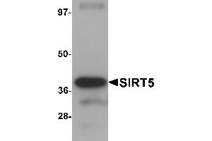 Western blot analysis of SIRT5 in human liver tissue lysate with SIRT5 antibody at 1 µg/mL.