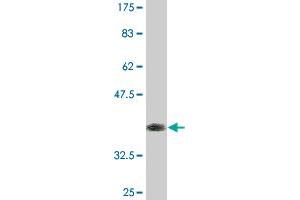 Western Blot detection against Immunogen (37. (ZBTB25 antibody  (AA 331-435))