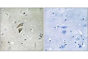 Immunohistochemistry (IHC) image for anti-Ring Finger Protein 149 (RNF149) (AA 211-260) antibody (ABIN2890291) (RNF149 antibody  (AA 211-260))