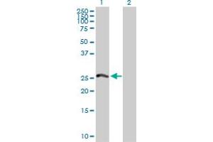 Western Blot analysis of PSMA8 expression in transfected 293T cell line by PSMA8 MaxPab polyclonal antibody. (PSMA8 antibody  (AA 1-250))