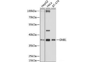 Western blot analysis of extracts of various cell lines using GNB1 Polyclonal Antibody at dilution of 1:1000. (GNB1 antibody)