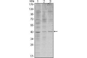 Western blot analysis using WIF1 mouse mAb against Hela (1), NIH/3T3 (2) and NTERA-2 (3) cell lysate.