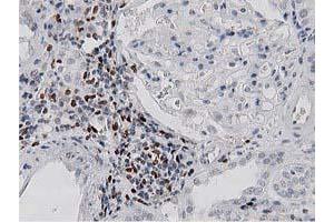 Immunohistochemical staining of paraffin-embedded Human Kidney tissue using anti-MSI1 mouse monoclonal antibody. (MSI1 antibody)