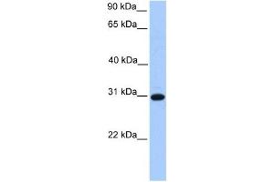 ETFB antibody used at 1 ug/ml to detect target protein. (ETFB antibody  (C-Term))
