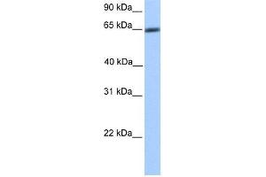 Transfected 293T; WB Suggested Anti-ZNF449 Antibody Titration: 0. (ZNF449 antibody  (N-Term))