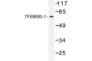 Image no. 1 for anti-BRF1, RNA polymerase III transcription initiation factor subunit (BRF1) antibody (ABIN317615) (BRF1 antibody)