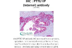 Image no. 1 for anti-Pituitary Tumor-Transforming 1 Interacting Protein (PTTG1IP) (Internal Region) antibody (ABIN1738624)