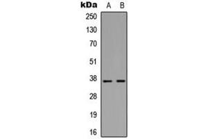 Western blot analysis of MMP10 expression in Jurkat (A), HepG2 (B) whole cell lysates.