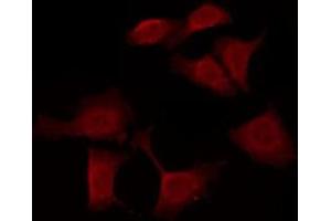 ABIN6276070 staining Hela by IF/ICC. (OR10J6P antibody)