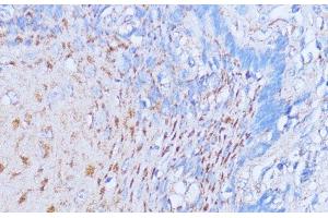 Immunohistochemistry of paraffin-embedded Human esophageal using NME6 Polyclonal Antibody at dilution of 1:100 (40x lens).