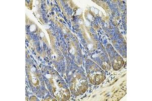 Immunohistochemistry of paraffin-embedded mouse intestine using EIF3C Antibody. (EIF3C antibody  (AA 694-913))