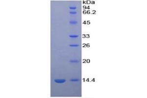 SDS-PAGE of Protein Standard from the Kit  (Highly purified E. (PF4 ELISA Kit)