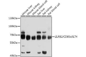 Western blot analysis of extracts of various cell lines, using LILRB2/CD85d/ILT4 antibody (ABIN6131861, ABIN6143217, ABIN6143219 and ABIN6214278) at 1:1000 dilution. (LILRB2 antibody)