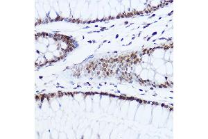 Immunohistochemistry of paraffin-embedded human colon using [KO Validated] Histone H1. (Histone H1 antibody  (AA 1-105))