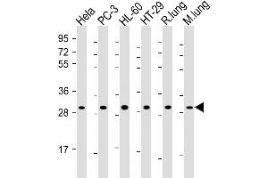 Western Blot at 1:2000 dilution Lane 1: Hela whole cell lysate Lane 2: PC-3 whole cell lysate Lane 3: HL-60 whole cell lysate Lane 4: HT-29 whole cell lysate Lane 5: rat lung lysate Lane 6: mouse lung lysate Lysates/proteins at 20 ug per lane. (RPS4X antibody  (AA 209-243))