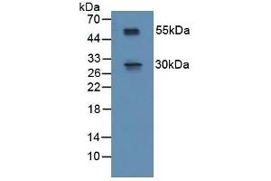 Detection of RSPO1 in Mouse Spinal Cord Tissue using Polyclonal Antibody to R-Spondin 1 (RSPO1) (RSPO1 antibody  (AA 21-135))