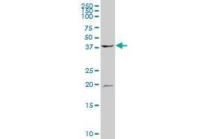 ATP6V1C1 polyclonal antibody (A01), Lot # 050914JC01. (ATP6V1C1 antibody  (AA 1-110))