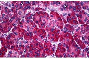 Human Pancreas: Formalin-Fixed, Paraffin-Embedded (FFPE) (Calreticulin antibody  (AA 1-339))