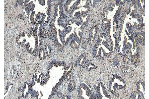 ABIN334371 (8µg/ml) staining of paraffin embedded Human Prostate. (CEP290 antibody  (Internal Region))