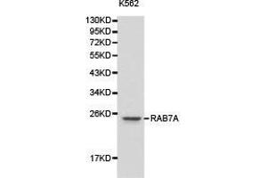 Western Blotting (WB) image for anti-RAB7A, Member RAS Oncogene Family (RAB7A) antibody (ABIN1874518) (RAB7A antibody)