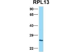 Western Blotting (WB) image for anti-Ribosomal Protein L13 (RPL13) (C-Term) antibody (ABIN2778677)