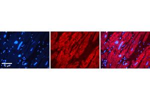 Rabbit Anti-DMAP1 Antibody   Formalin Fixed Paraffin Embedded Tissue: Human heart Tissue Observed Staining: Cytoplasmic Primary Antibody Concentration: 1:100 Other Working Concentrations: N/A Secondary Antibody: Donkey anti-Rabbit-Cy3 Secondary Antibody Concentration: 1:200 Magnification: 20X Exposure Time: 0. (DMAP1 antibody  (N-Term))
